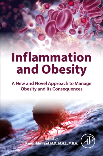 Inflammation and Obesity: A New and Novel Approach to Manage Obesity and its Consequences