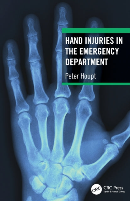 Hand Injuries in the Emergency Department