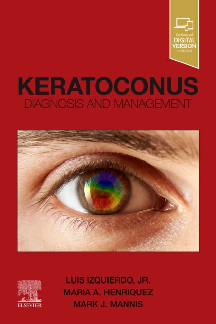 Keratoconus: Diagnosis and Management