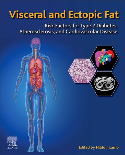 Visceral and Ectopic Fat: Risk Factors for Type 2 Diabetes, Atherosclerosis, and Cardiovascular Disease