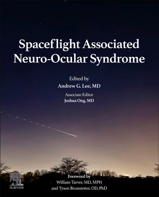 Spaceflight Associated Neuro-Ocular Syndrome