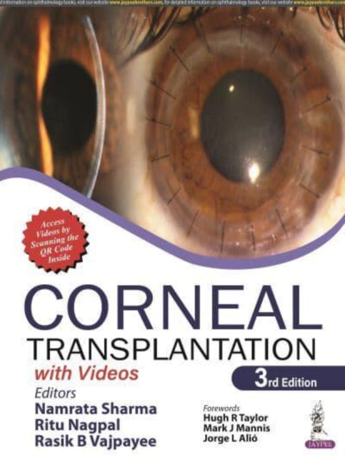 Corneal Transplantation: with Videos