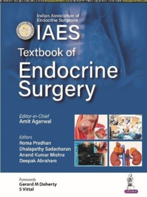 Textbook of Endocrine Surgery