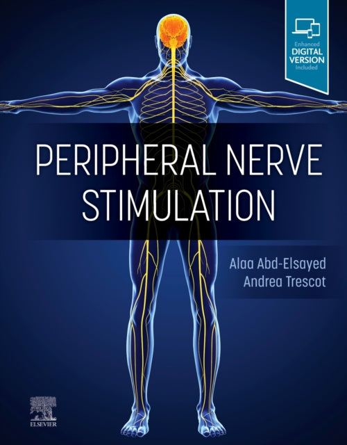 Peripheral Nerve Stimulation: A Comprehensive Guide