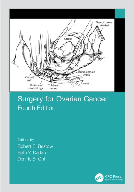 Surgery for Ovarian Cancer