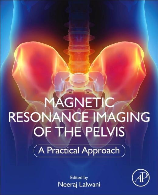 Magnetic Resonance Imaging of The Pelvis: A Practical Approach