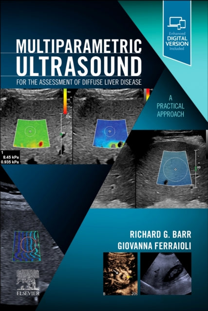 Multiparametric Ultrasound for the Assessment of Diffuse Liver Disease: A Practical Approach