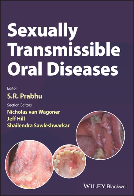 Sexually Transmissible Oral Diseases