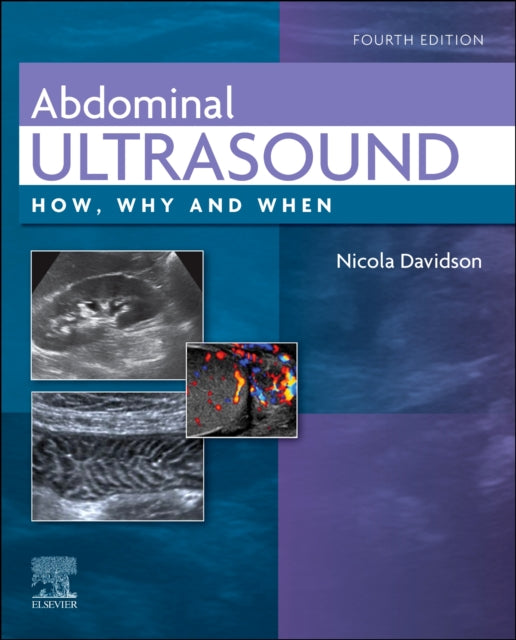 Abdominal Ultrasound: How, Why and When