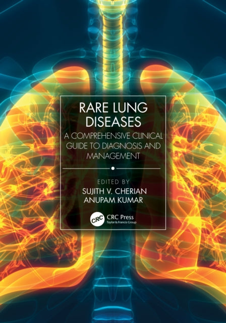 Rare Lung Diseases: A Comprehensive Clinical Guide to Diagnosis and Management