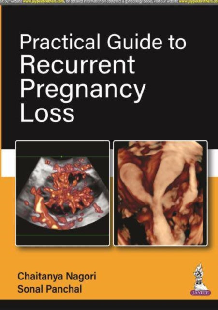 Practical Guide to Recurrent Pregnancy Loss