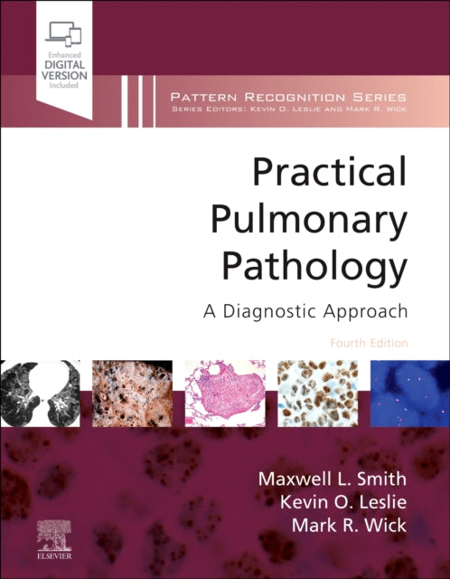 Practical Pulmonary Pathology: A Diagnostic Approach