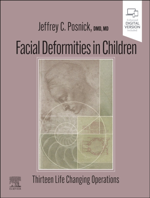 Facial Deformities in Children: Thirteen Life Changing Operations