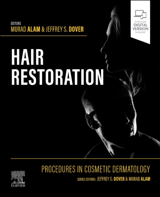 Procedures in Cosmetic Dermatology: Hair Restoration