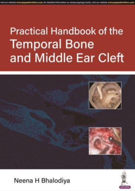 Practical Handbook of the Temporal Bone and Middle Ear Cleft