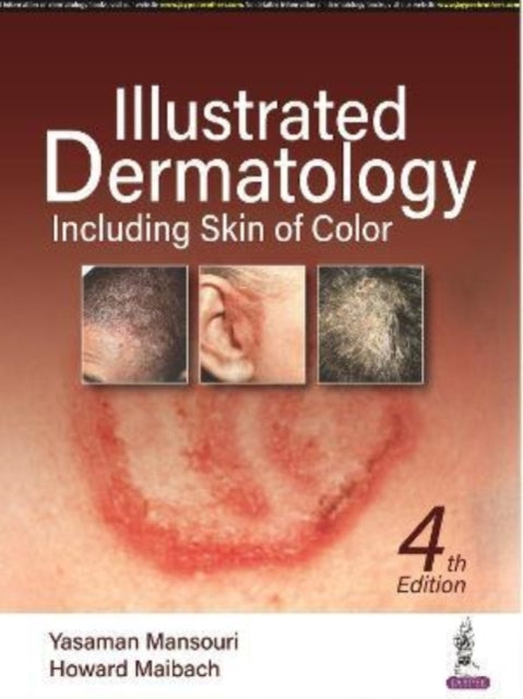 Illustrated Dermatology: Including Skin of Colour