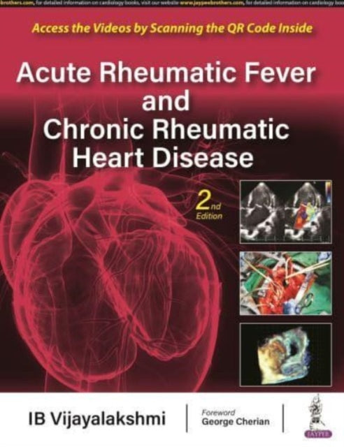 Acute Rheumatic Fever and Chronic Rheumatic Heart Disease