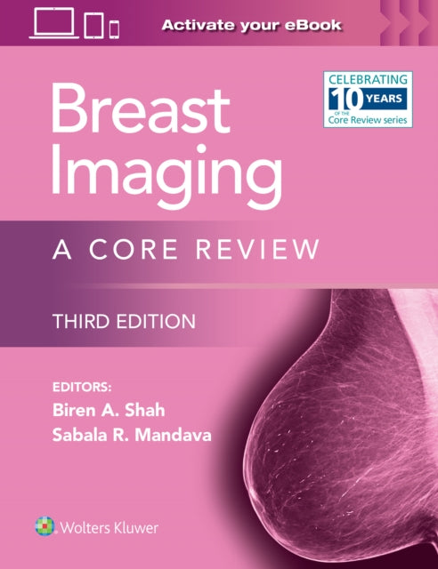 Breast Imaging: A Core Review