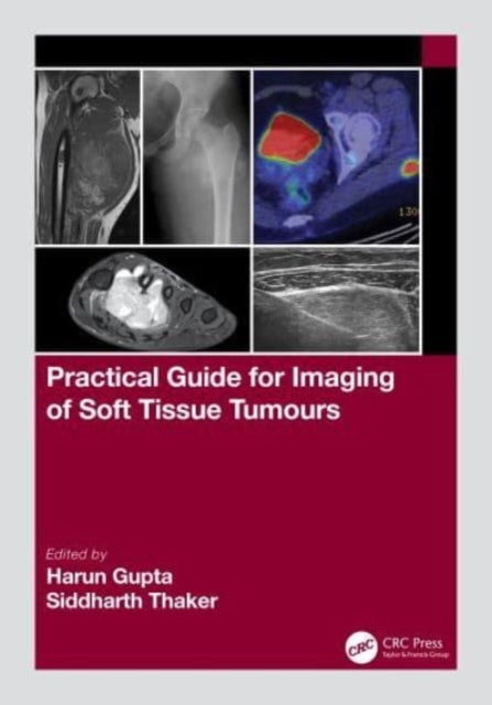 Practical Guide for Imaging of Soft Tissue Tumours