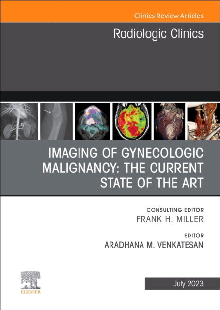 Imaging of Gynecologic Malignancy: The Current State of the Art, An Issue of Radiologic Clinics of North America