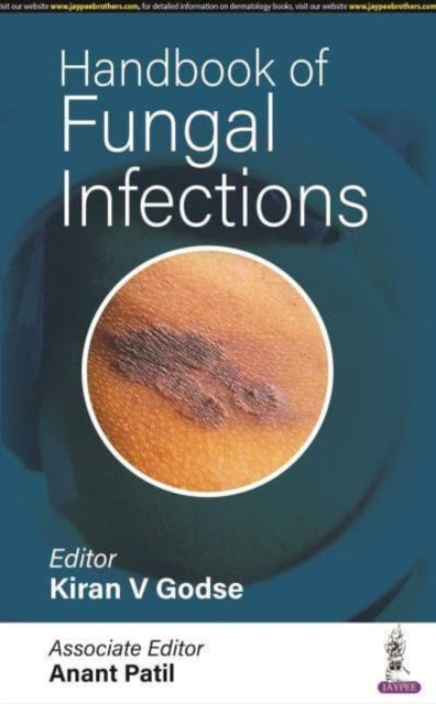 Handbook of Fungal Infections