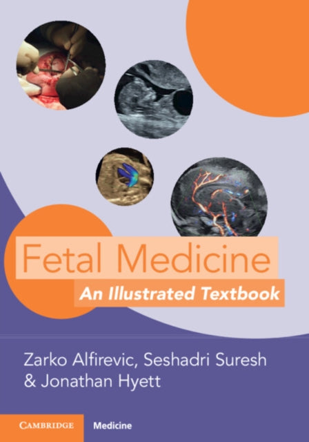 Fetal Medicine: An Illustrated Textbook