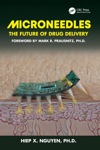 Microneedles: The Future of Drug Delivery