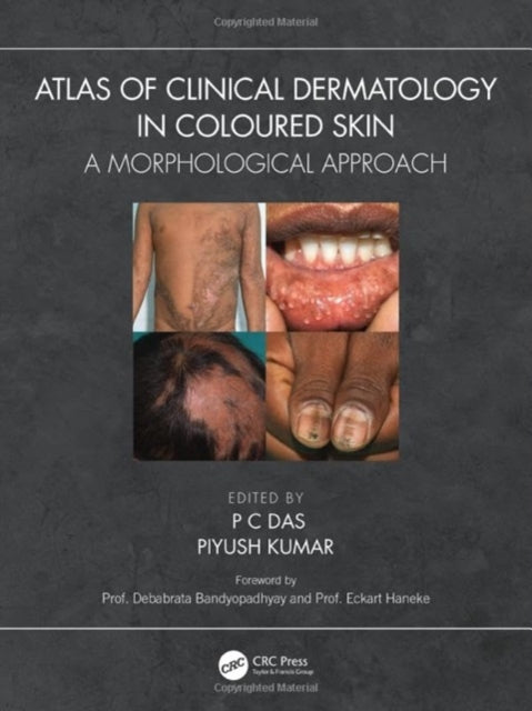 Atlas of Clinical Dermatology in Coloured Skin: A Morphological Approach