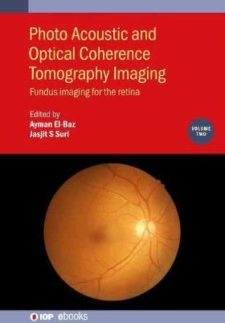 Photo Acoustic and Optical Coherence Tomography Imaging, Volume 2: Fundus imaging for the retina