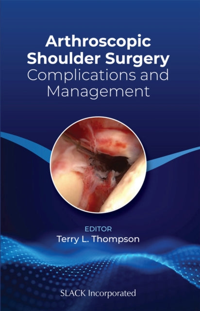 Arthroscopic Shoulder Surgery: Complications and Management