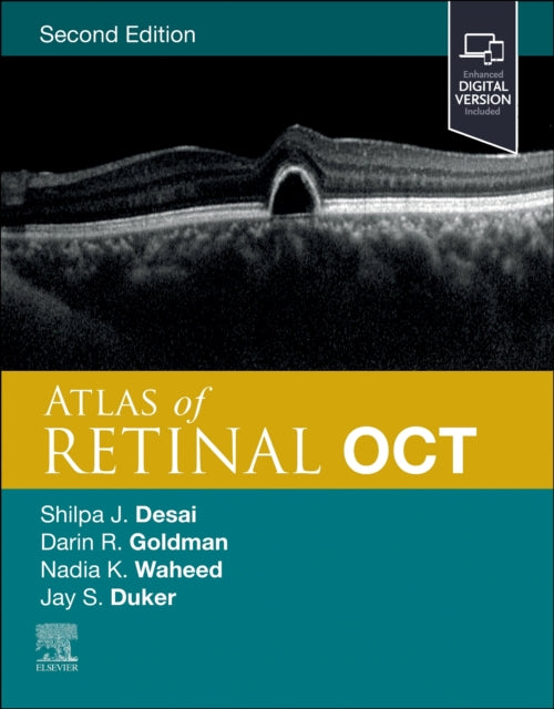 Atlas of Retinal OCT: Optical Coherence Tomography