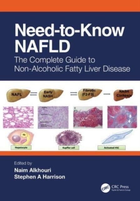 Need-to-Know NAFLD: The Complete Guide to Nonalcoholic Fatty Liver Disease