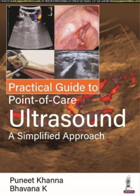 Practical Guide to Point of Care Ultrasound: A Simplified Approach