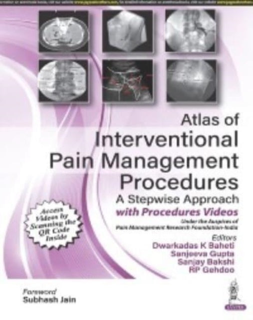 Atlas of Interventional Pain Management Procedures: A Stepwise Approach