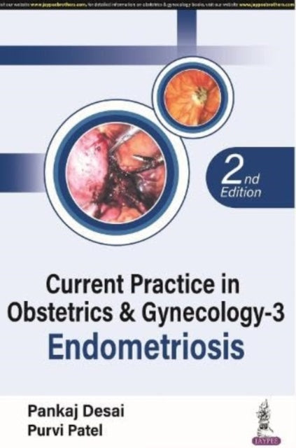 Current Practice in Obstetrics & Gynecology - 3: Endometriosis