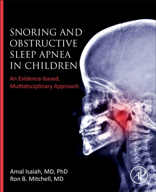 Snoring and Obstructive Sleep Apnea in Children: An Evidence-Based, Multidisciplinary Approach