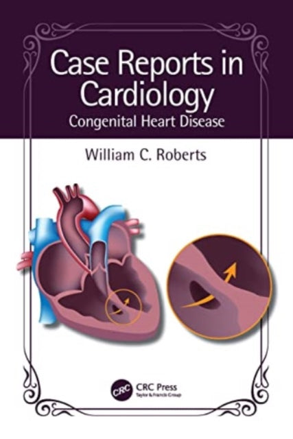 Case Reports in Cardiology: Congenital Heart Disease