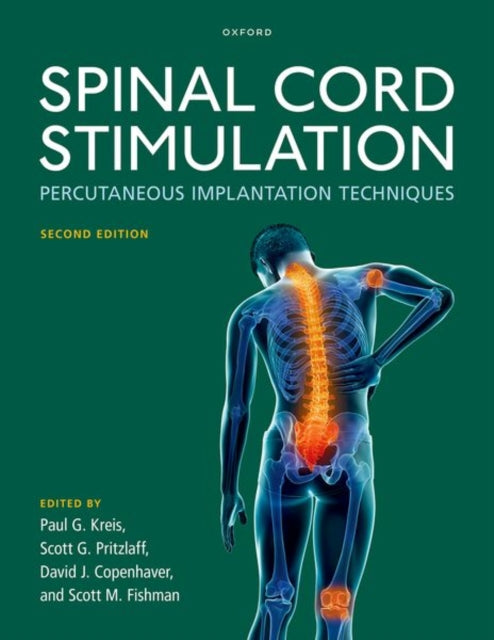 Spinal Cord Stimulation: Percutaneous Implantation Techniques