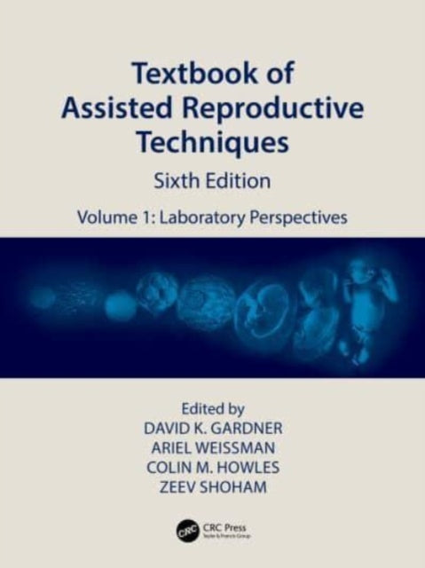 Textbook of Assisted Reproductive Techniques: Volume 1: Laboratory Perspectives