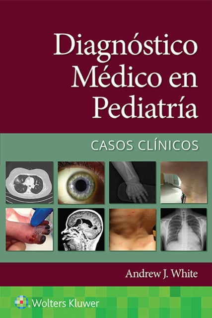 Diagnostico medico en pediatria. Casos clinicos