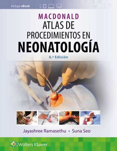 MacDonald. Atlas de procedimientos en neonatologia