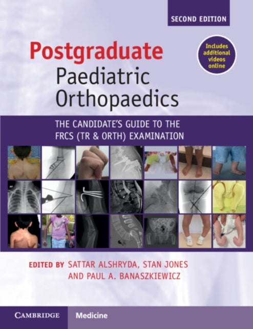 Postgraduate Paediatric Orthopaedics: The Candidate's Guide to the FRCS(Tr&Orth) Examination