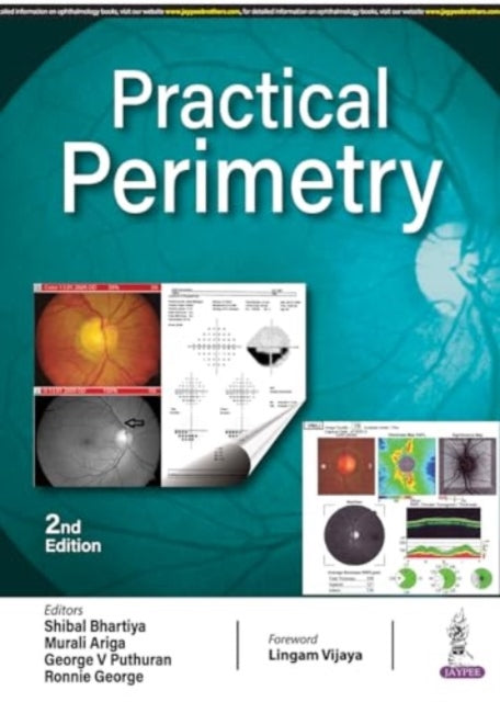 Practical Perimetry