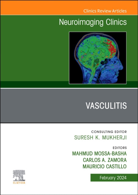 Vasculitis, An Issue of Neuroimaging Clinics of North America