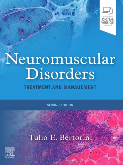 Neuromuscular Disorders: Treatment and Management