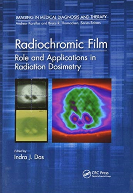 Radiochromic Film: Role and Applications in Radiation Dosimetry