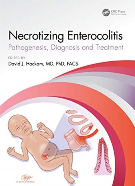Necrotizing Enterocolitis: pathogenesis, diagnosis and treatment