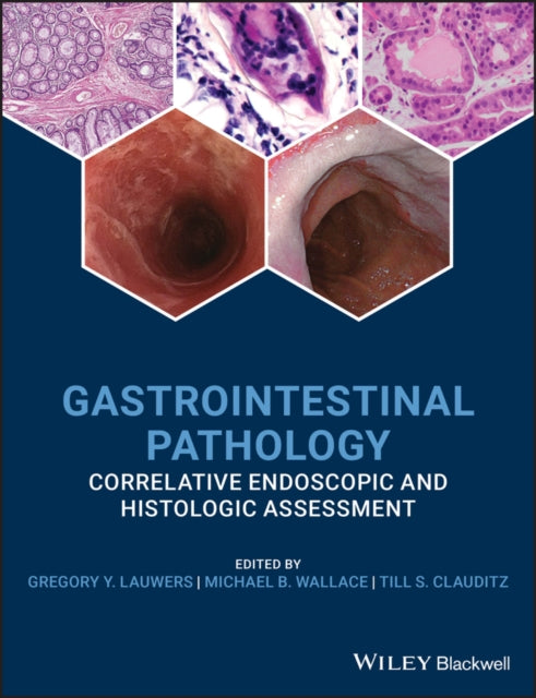 Gastrointestinal Pathology: Correlative Endoscopic and Histologic Assessment