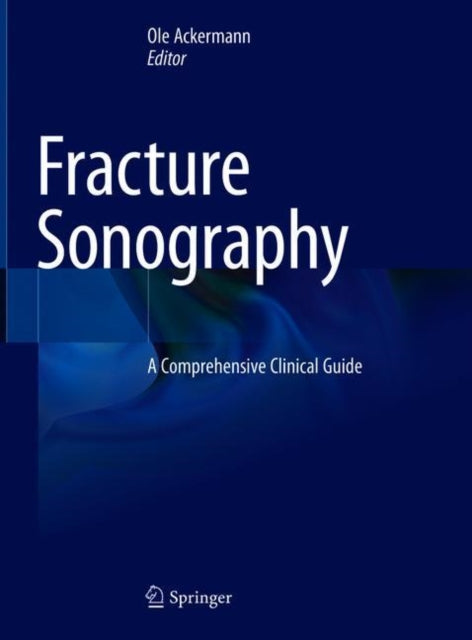 Fracture Sonography: A Comprehensive Clinical Guide