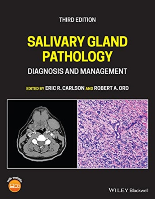 Salivary Gland Pathology: Diagnosis and Management